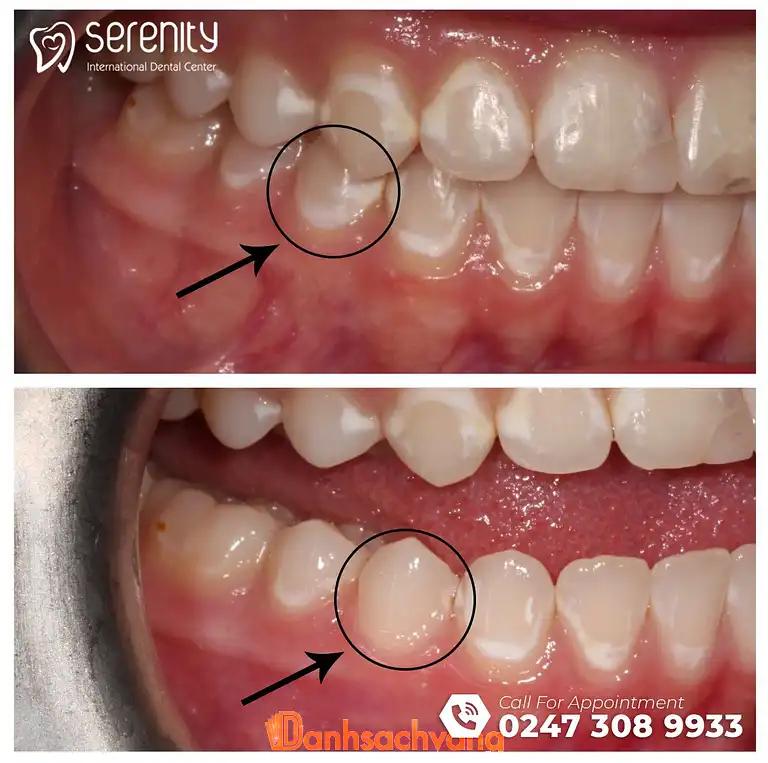 Hình ảnh picasso-dental-clinic-da-nang-3