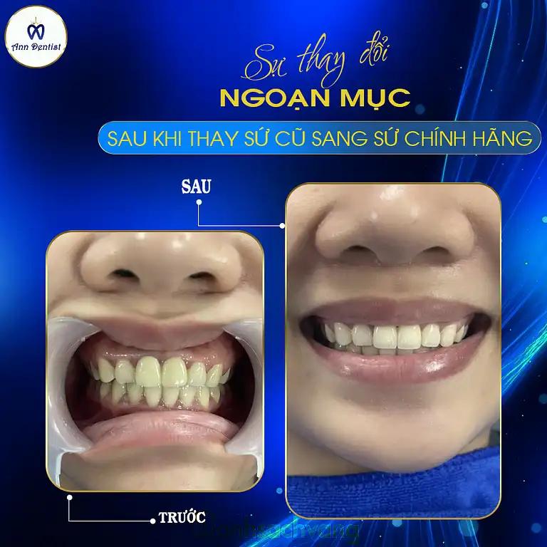 Hình ảnh nha-khoa-ann-dentist-208-nguyen-cong-tru-son-tra-2