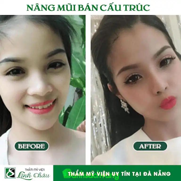 Hình ảnh Thẩm mỹ viện Linh Châu: 6 Ngô Gia Tự, Hải Châu