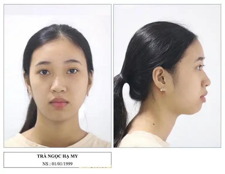 Hình ảnh nha-khoa-a-t-170-nguyen-huu-tho-hai-chau-2