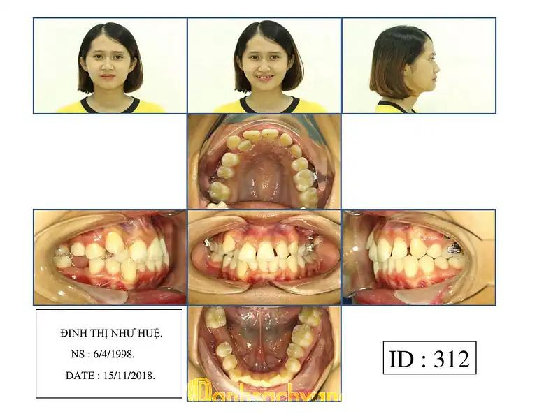 Hình ảnh nha-khoa-a-t-170-nguyen-huu-tho-hai-chau-4