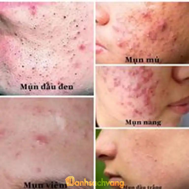 Hình ảnh em-dep-spa-50-phan-van-dinh-lien-chieu-3