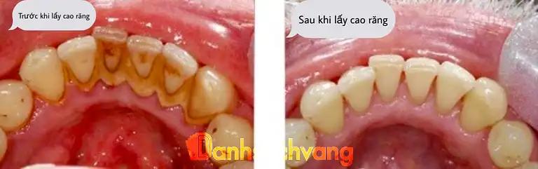 Hình ảnh nha-khoa-vcare-190-kinh-duong-vuong-lien-chieu-5
