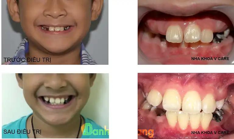 Hình ảnh nha-khoa-vcare-190-kinh-duong-vuong-lien-chieu-2