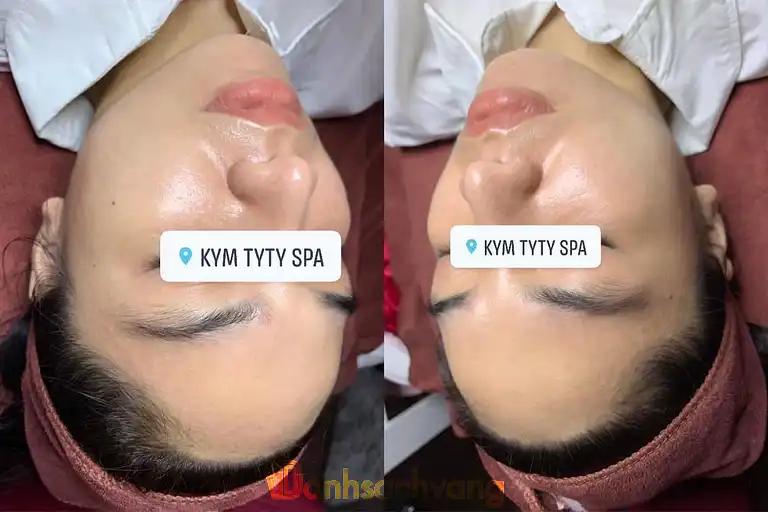 Hình ảnh kym-tyty-spa-dt-409-hoa-vang-4