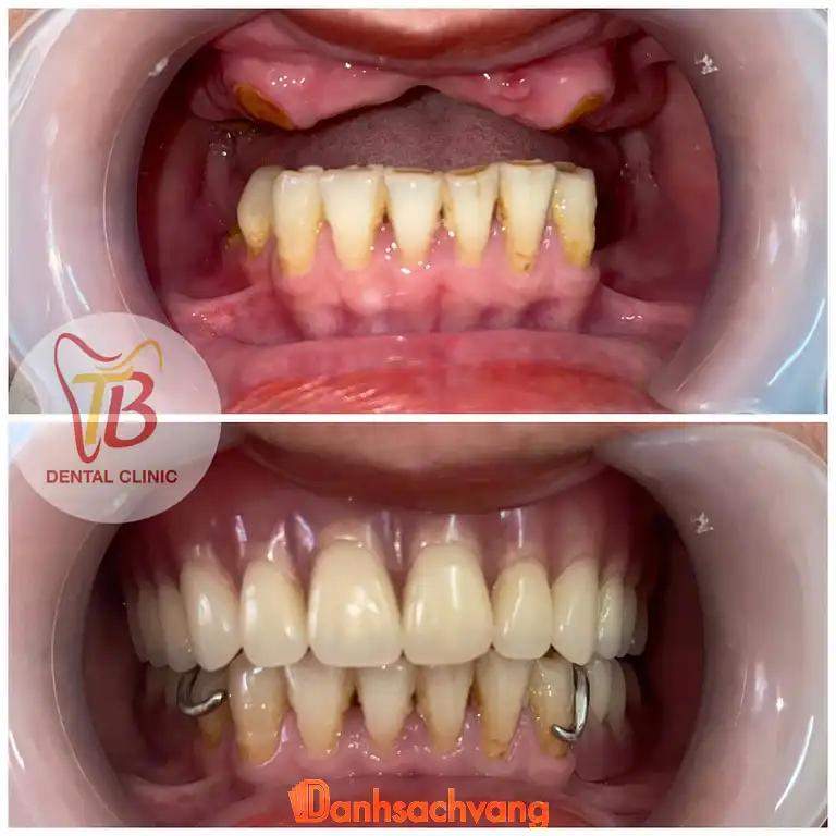 Hình ảnh nha-khoa-thien-bao-99-hoang-van-thai-lien-chieu-4