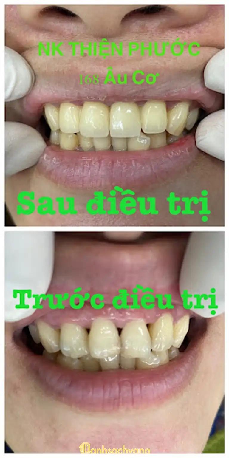 Hình ảnh nha-khoa-thien-phuoc-168-au-co-lien-chieu-5