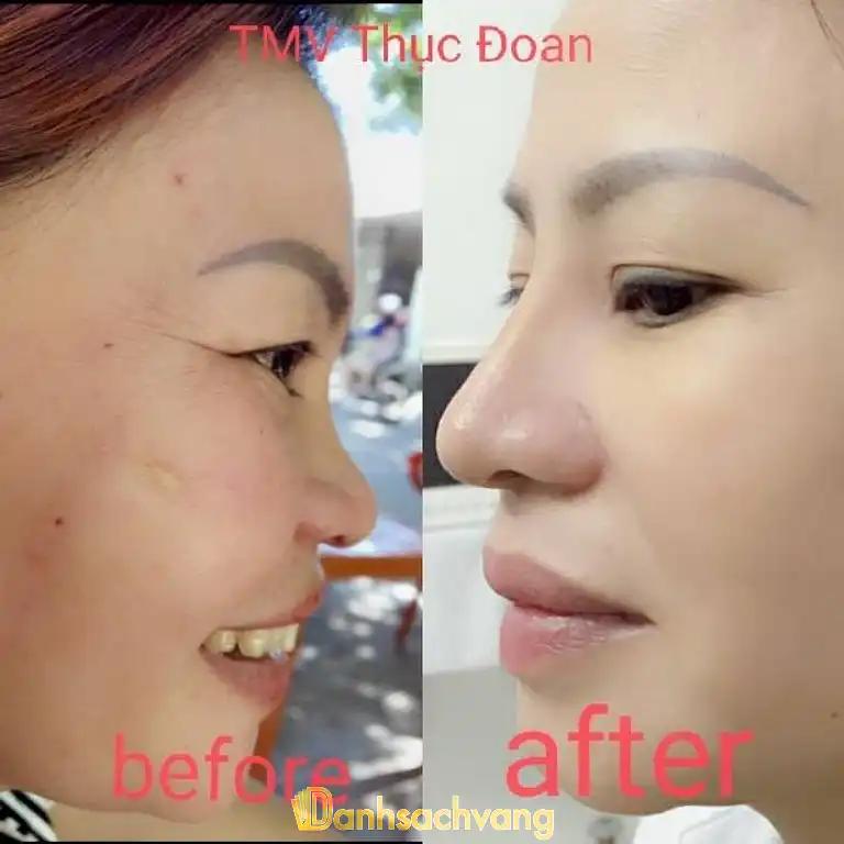 Hình ảnh tham-my-vien-thuc-doan-572-ngo-quyen-son-tra-5