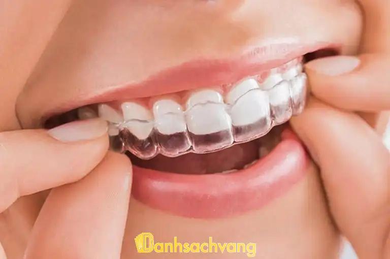 Hình ảnh nha-khoa-nieng-rang-trong-suot-invisalign-tai-ha-noi-01