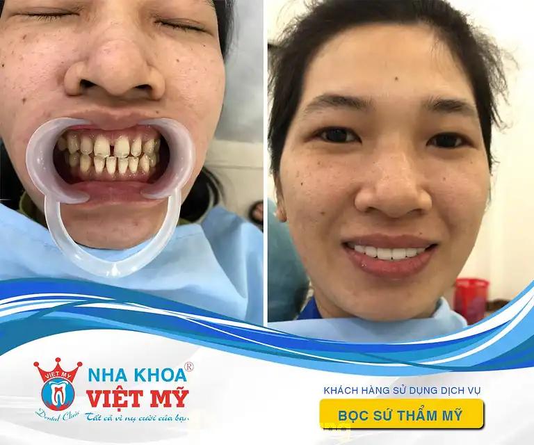 Hình ảnh Nha Khoa Việt Mỹ: 135 Lê Lợi, TP Tuy Hòa