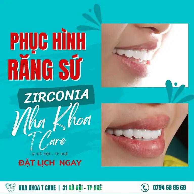 Hình ảnh NHA KHOA T-CARE:  31 Hà Nội,Tp Huế