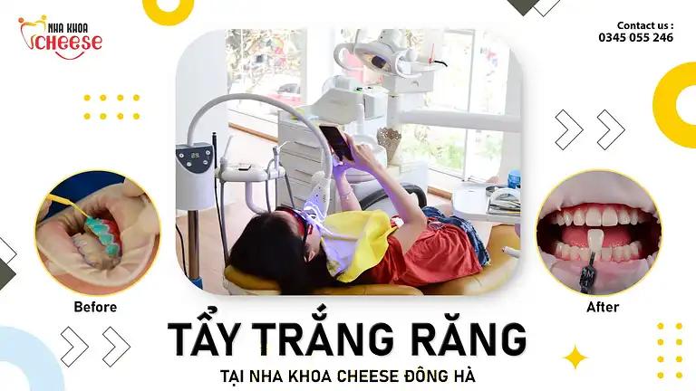 Hình ảnh NHA KHOA CHEESE: 18 Trần Hưng Đạo, Tp Đông Hà