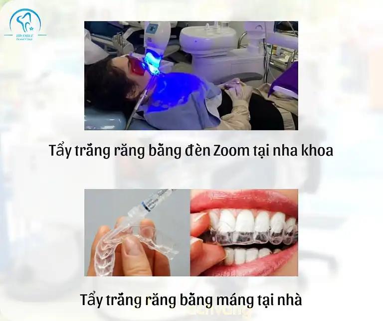 Hình ảnh nha-khoa-hd-smile-152-hong-mai-hai-ba-trung-5