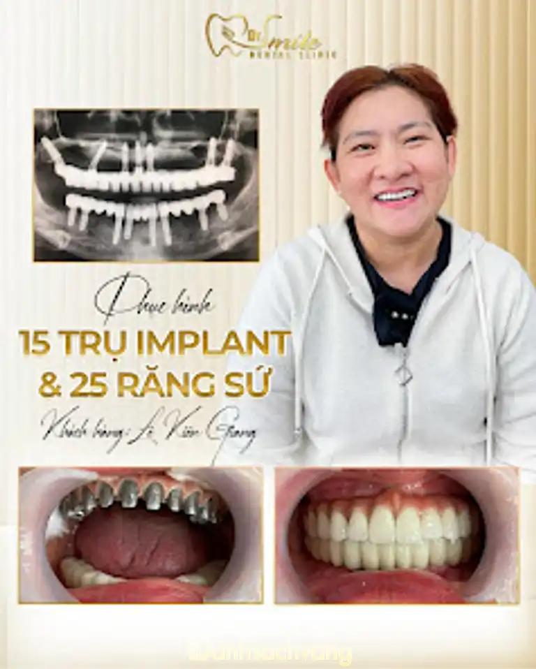 Hình ảnh nha-khoa-dr-smile-kien-giang-05-tran-phu-tp-rach-gia-003