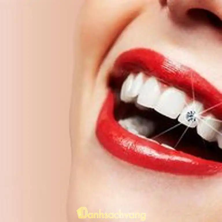 Hình ảnh Nha Khoa Bến Thành:3 Nguyễn Văn Tre,TP Cao Lãnh