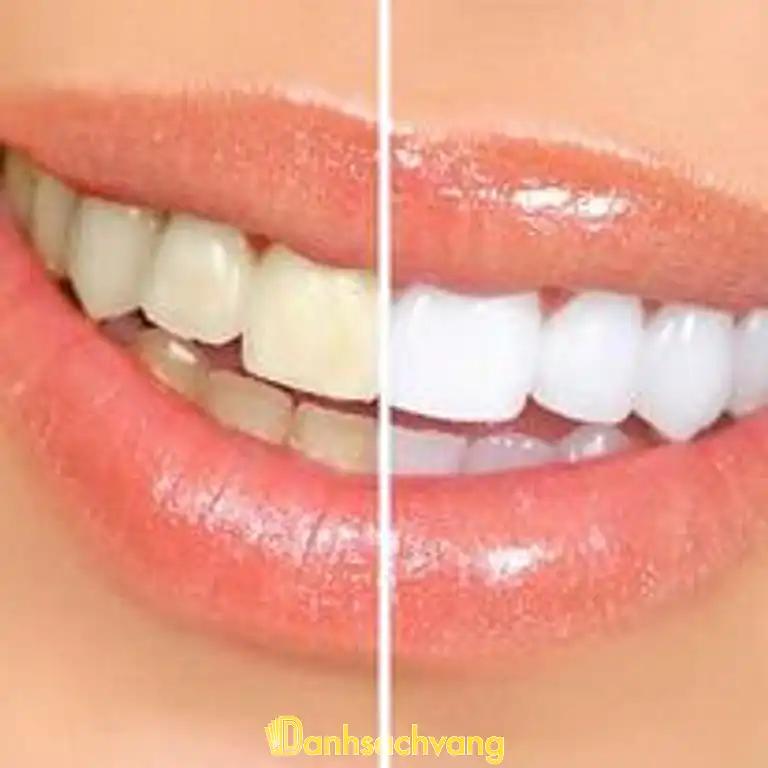 Hình ảnh Nha Khoa Bến Thành:3 Nguyễn Văn Tre,TP Cao Lãnh