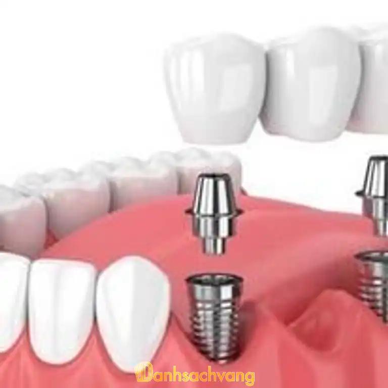 Hình ảnh Nha Khoa Bảo Sơn: 91 Lê Hồng Phong, Tp Kon Tum