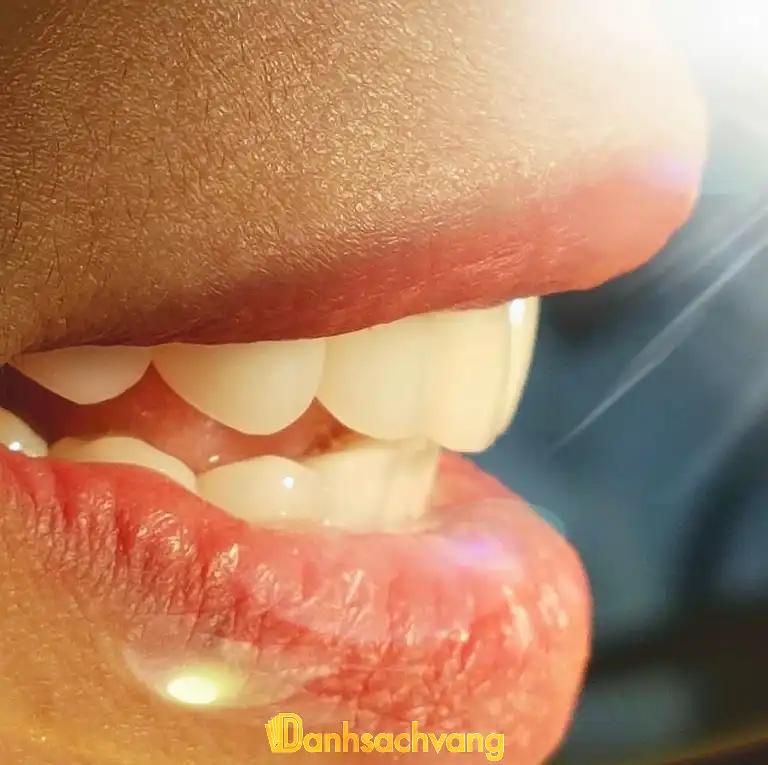Hình ảnh Nha Khoa Yến Ngọc