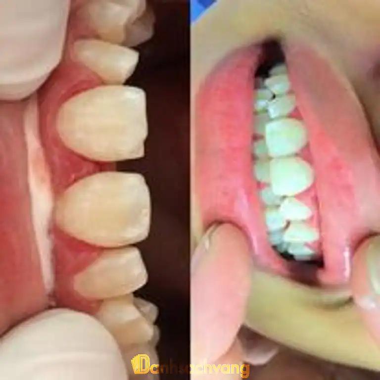 Hình ảnh Nha Khoa 804: 804 Đ. Hùng Vương,Tp Việt Trì
