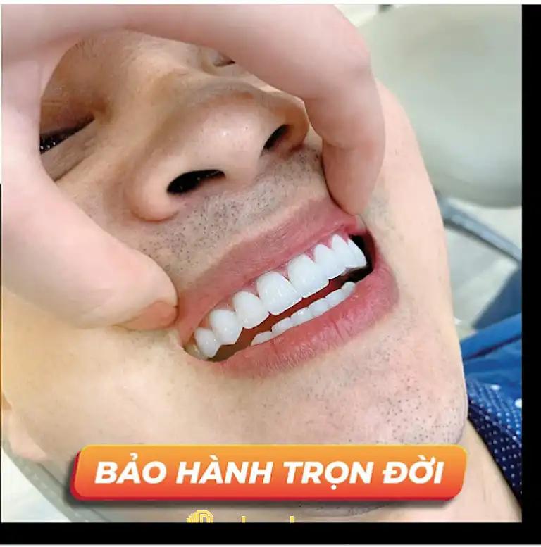 Hình ảnh Nha khoa Quốc Tế 3: 48 Hoàng Diệu, Tp Long Khánh