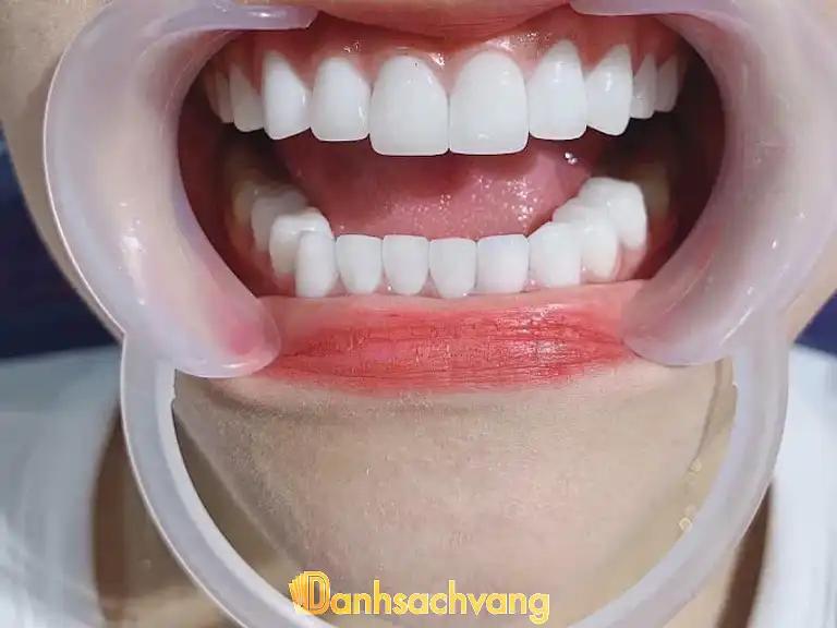 Hình ảnh Nha khoa Quốc Tế 3: 48 Hoàng Diệu, Tp Long Khánh