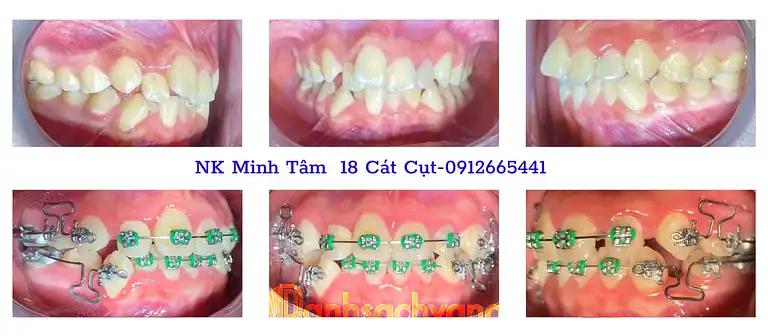 Hình ảnh Nha Khoa Minh Tâm: 18 Cát Cụt, Lê Chân, Tp Hải Phòng