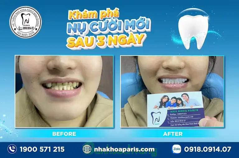 Hình ảnh nha-khoa-paris-6-461-tran-hung-dao-di-an-4