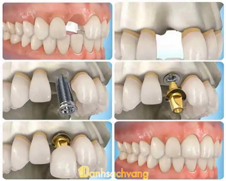 Hình ảnh Nha Khoa Sunny Dr Thuyên: 183 Lê Lợi, Tp Thái Bình