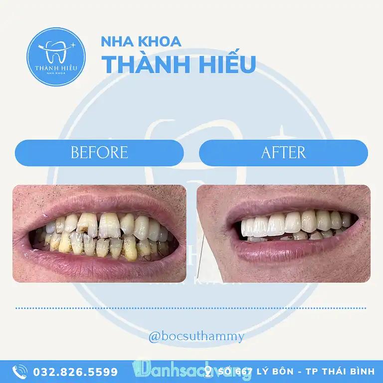 Hình ảnh Nha Khoa Thành Hiếu: 667 Lý Bôn, Tp Thái Bình