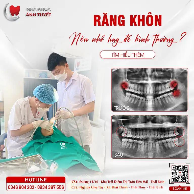 Hình ảnh Nha khoa Ánh Tuyết: QL39B, Tây Giang, Tiền Hải, Thái Bình