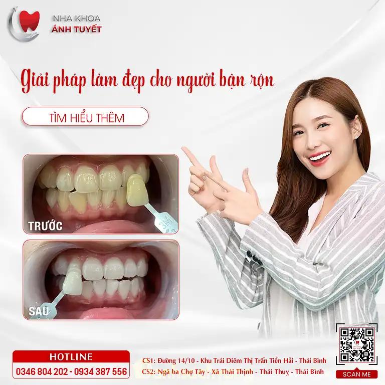 Hình ảnh Nha khoa Ánh Tuyết: QL39B, Tây Giang, Tiền Hải, Thái Bình