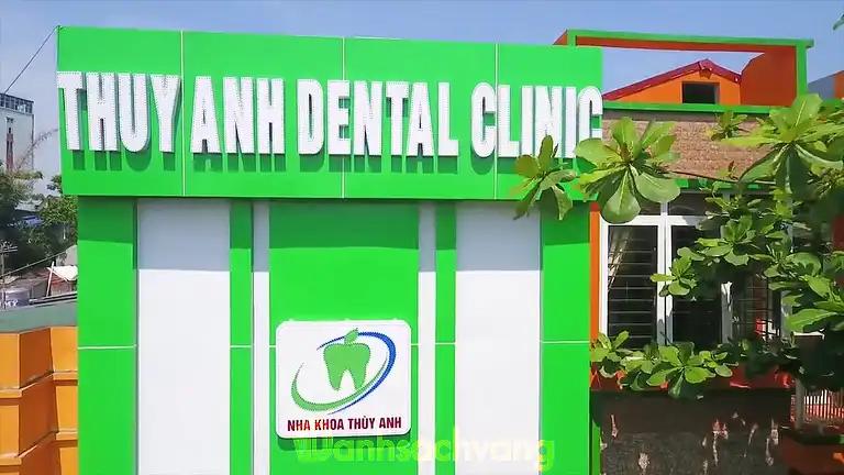 Hình ảnh nha khoa thuỳ anh tại tp thái nguyên