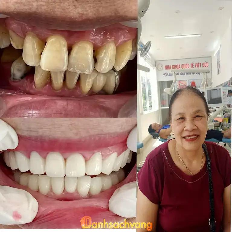 Hình ảnh Nha Khoa Quốc Tế Việt Đức: 22 T2,Tp Cao Bằng