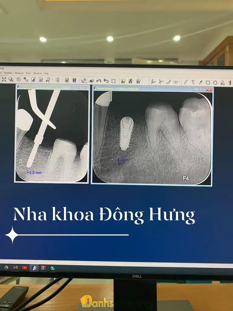 Hình ảnh Nha khoa Đông Hưng: 141 QL39A, TT. Đông Hưng, Thái Bình