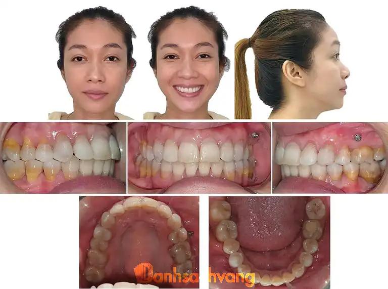Hình ảnh nha-khoa-viet-338-tran-nguyen-han-tp-hai-phong-4