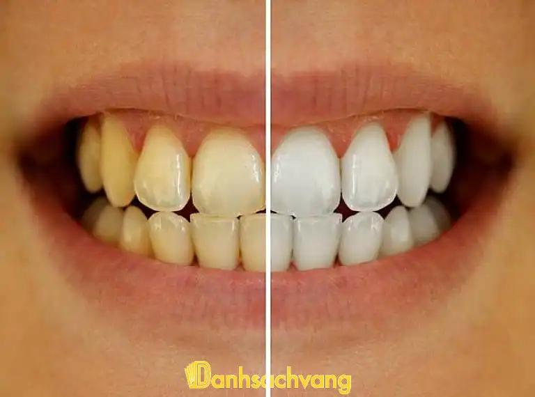 Hình ảnh Nha Khoa An Bình