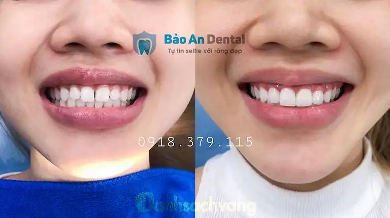 Hình ảnh Nha Khoa Thẩm Mỹ Bảo An Dental: Ấp 3, Định Quán