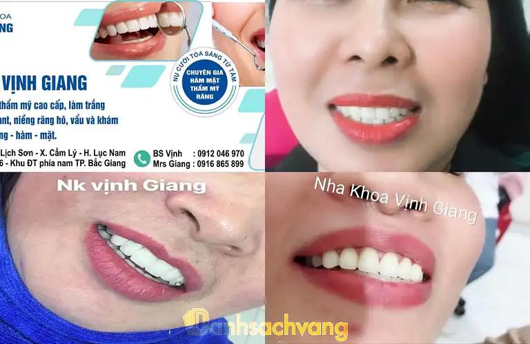 Hình ảnh Nha khoa Vịnh Giang: lô 39, Lê Duẩn, kđt BigC, Tp Bắc Giang