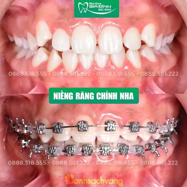 Hình ảnh Nha khoa Gia Đình: Đ. Trần Hưng Đạo, Quế Võ, Bắc Ninh