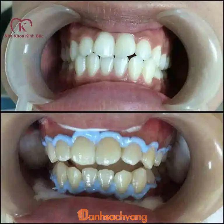 Hình ảnh Nha Khoa Kinh Bắc: 54 Nguyễn Văn Cừ, Tp Bắc Ninh