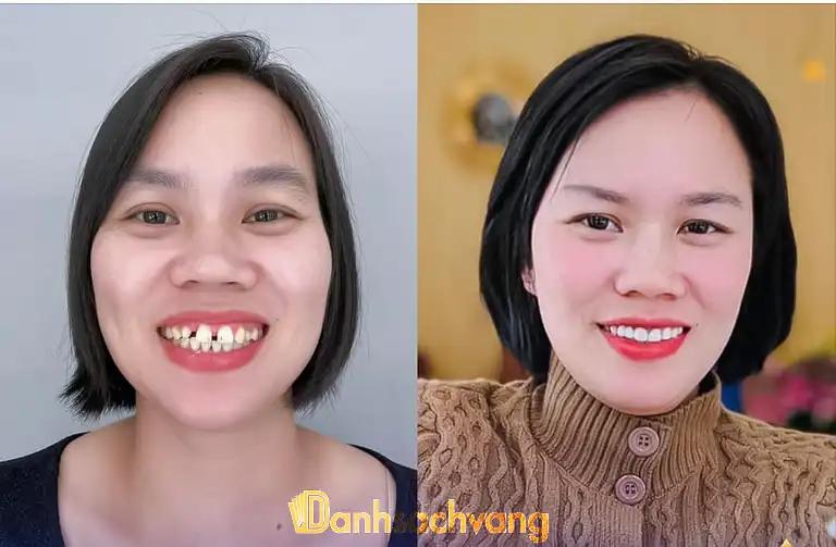 Hình ảnh Nha khoa 108: Ngã 3 Đông Dương Núi, Tp Bắc Ninh