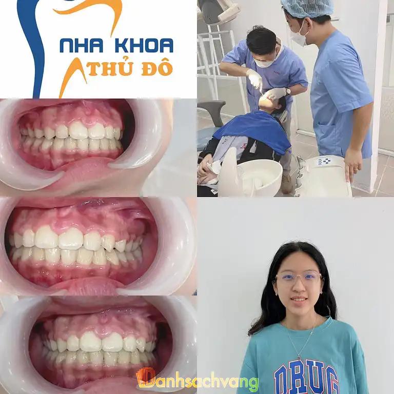 Hình ảnh Nha Khoa Thủ Đô