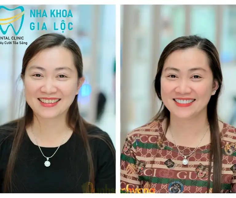 Hình ảnh nha-khoa-gia-loc-49-ngo-van-so-ninh-kieu-3