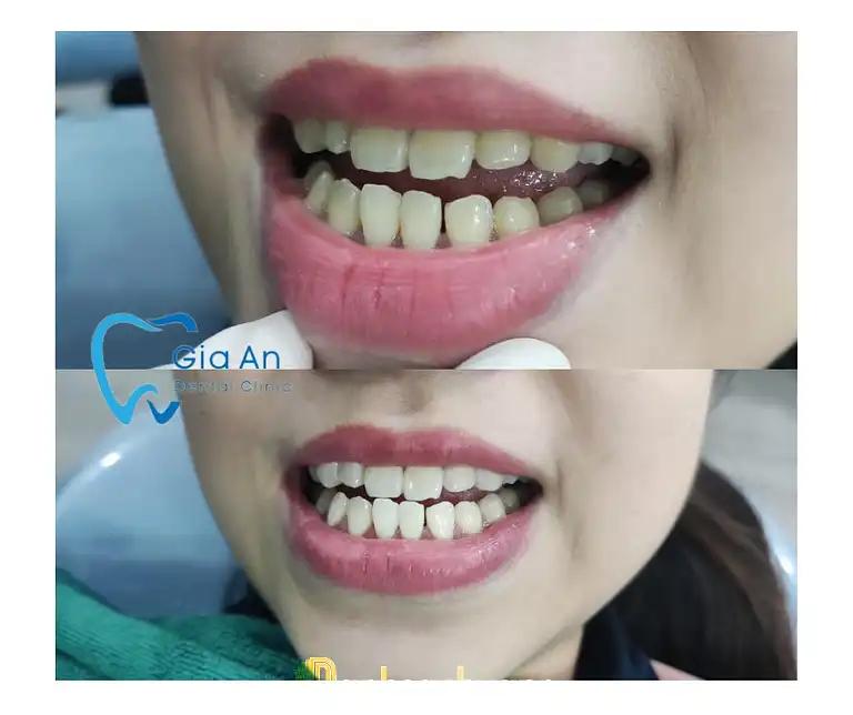 Hình ảnh Nha Khoa Gia An