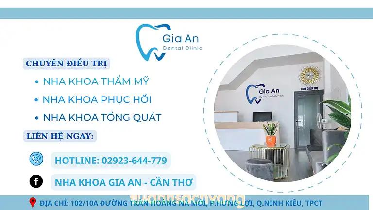 Hình ảnh Nha Khoa Gia An