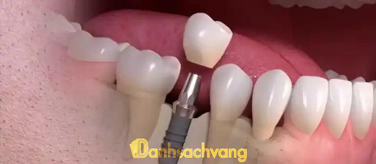 Hình ảnh Nha Khoa Huyền Mỹ 2