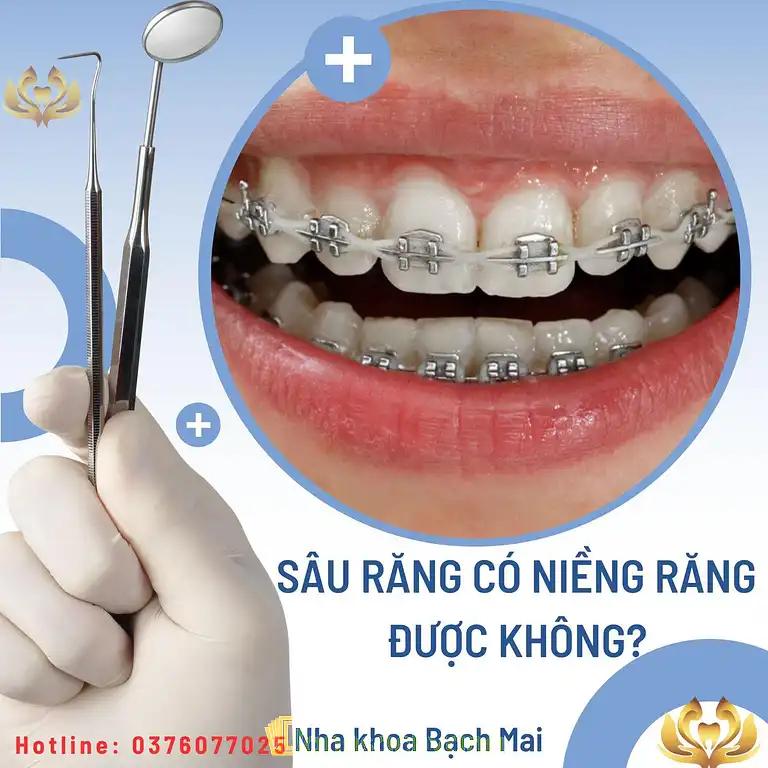 Hình ảnh Nha khoa Bạch Mai Bắc Ninh: Đào Viên, Tx Quế Võ, Bắc Ninh