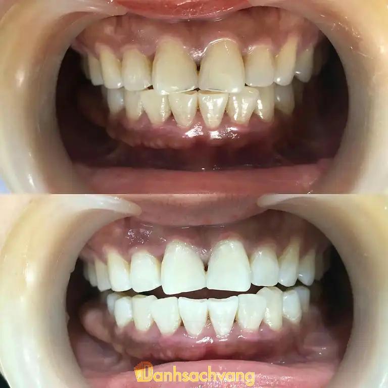 Hình ảnh Nha Khoa Cần Thơ