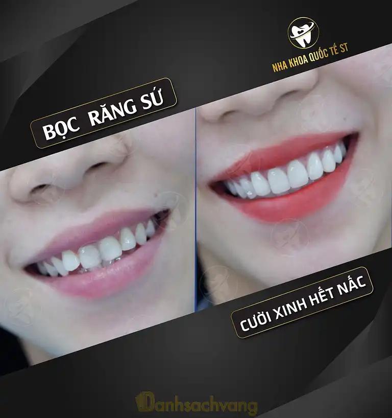 Hình ảnh Nha Khoa Quốc Tế ST