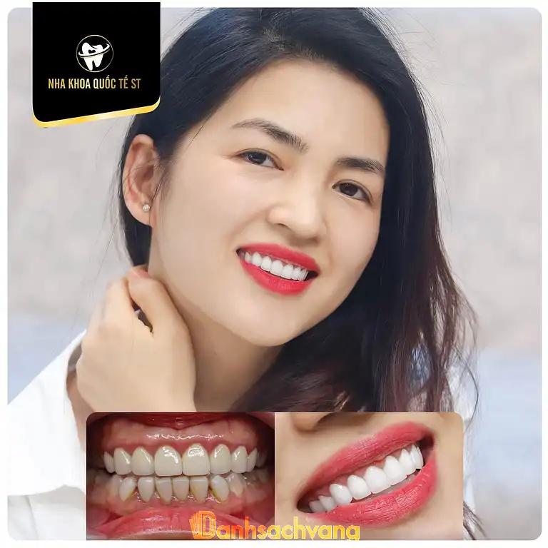 Hình ảnh Nha Khoa Quốc Tế ST